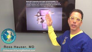 How Upper Cervical Instability Affects the Brain Stem - Ross Hauser, MD