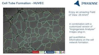 Cell Tube Formation - HUVEC on Matrigel