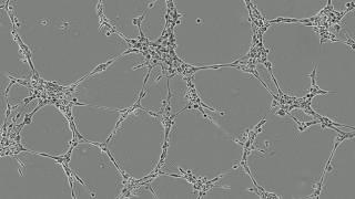 Formation of lumens by endothelial cells in vitro