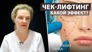 Подтяжка средней зоны лица методом чек-лифтинг