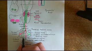 Amyotrophic Lateral Sclerosis (ALS) Part 4