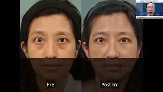 Feb. 5th. 2023 The International Craniofacial Chang Gung Webinar