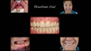 Dra. Yadelsi Sánchez-Rehabilitación_Parte I