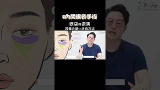 眼袋與淚溝四種分期法vs手術方式                 #Shorts #周杰醫師 #眼袋手術 #內開眼袋手術 #外開眼袋手術 #淚溝 #蘋果肌