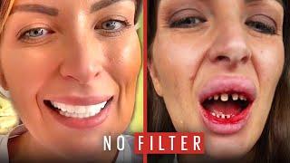 The Horrible Truth Behind My 'Turkey Teeth' | No Filter | @ladbiblestories