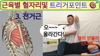 근육별 혈자리 및 트리거포인트 " 전거근!! " ( 팔이.. 올라가기 시작한다 )