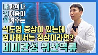 위도 운동부족 현상을 겪는다?  비미란성 위산역류!