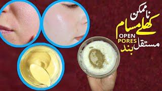 Open Pores Khtam Karne ka Tarika | Open Pores Treatment