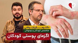 اگزما در کودکان و نوزادان چگونه درمان می شود؟ با دکتر مازیار ترخانی در برنامه طبیب