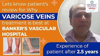 Best treatment centre for varicose vein in India …Bankers Vascular Hospital