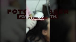 7 Benefits of Fotona Laser for hair growth | Hair treatment | HairMD Pune