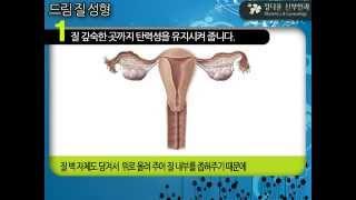 [성남 정다운산부인과] 드림질성형 수술법,요실금수술,소음순수술,요실금치료 15년 저명의 원영석 원장