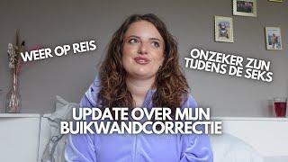 Q&A over afvallen, buikwandcorrectie, reizen en onzekerheden