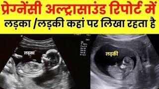 Pregnancy ultrasound se kaise pata krein ki ladka hai ya ladki