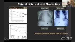 IAPTCB Webinar - Management of CHF - Dr Nageswar Rao