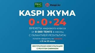 В Dent-lux РАССРОЧКА НА 24 МЕСЯЦА от Kaspi.kz на БРЕКЕТЫ!