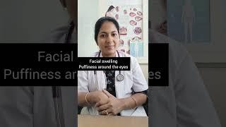 Hypothyroidism..What to look for? #hypothyroid #thyroidgland #symptoms  #healthtip #doctor #drdivya