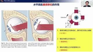 演讲：共同性斜视合并的“非共同性”问题——水平直肌肌肉止端移位手术