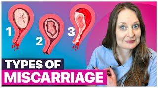 10 Kinds of Miscarriages: Understanding the Difference and Why It Matters