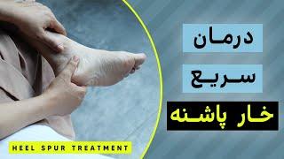 چطور خار پاشنه را در منزل درمان کنیم - Heel spur treatment