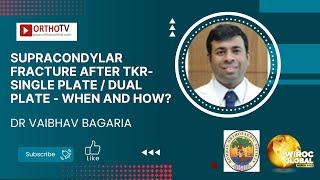 Supracondylar fracture after TKA-Single plate / Dual plate - When and how? - Dr Vaibhav Bagaria