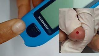 CBG Monitoring #bloodsugarmonitoring #bloodglucose #cbg #glucosemonitoring #glucometer #nursing Tube