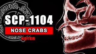 SCP-1104  - The Nose Crabs