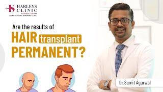 Are the hair transplant results permanents? | Best Hair Transplants clinic in Mumbai |Harleys clinic