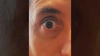 Man Dilates Pupils on Demand || ViralHog