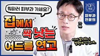 여드름 났을 때 피부과 가지 말고 집에서 "이것"만 바르면 싹 좋아집니다 | 처방 없이도 싹 낫는 여드름연고 추천