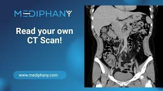 How to read your own CT scan