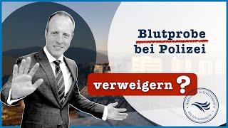 Blutprobe – bei Polizei verweigern? – Tipps vom Anwalt / Strafverteidiger in Freiburg