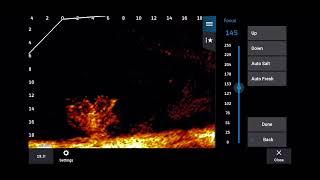 Garmin Livescope Focus: What Is It? How To Adjust It!!! How It Affects The Picture!!!