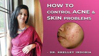 HOW TO CURE ACNE AND SKIN PROBLEMS । DR.SHELLEY INDORIA