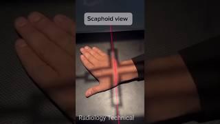 Scaphoid view # Pisiform bone x-ray view # patient Positioning #radiography #radiology