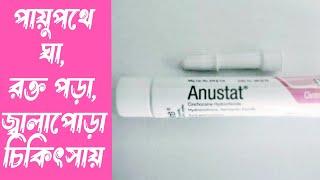 Anustat ointment | পায়ুপথে জ্বালাপোড়া ও ব্যথার ঔষধ