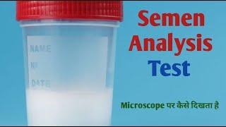 Semen test procedure I  sperm count