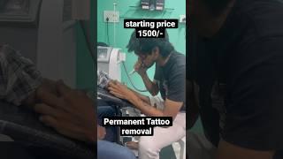 Permanent Tattoo removal / 9704707249 / Vijayawada