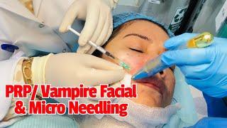 My first PRP/Vampire Facial & Micro Needling Experience for Face Rejuvenation I The Rhonzie Vlog