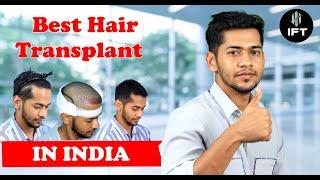 Best Hair Transplant in India | Affordable Cost of Hair Transplant - IFT Hair Science