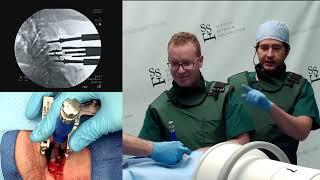 Artificial Disc Replacement - Rod J. Oskouian, Jr, MD