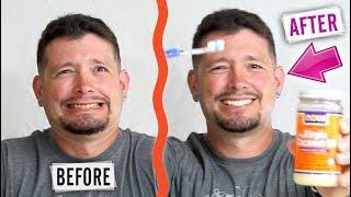 How to Whiten Teeth Naturally Using Coconut Oil - Easy DIY