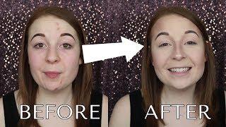 ACNE COVERAGE FOUNDATION ROUTINE | CHRISTINA ELIZABETH