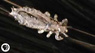 How Lice Turn Your Hair Into Their Jungle Gym | Deep Look