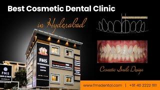 Best Cosmetic Dentist In Hyderabad | Smile Correction With Veneers, Smile Design Dental Clinic India