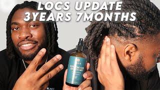 3 Years and 7 months Dreadlocks Update | Are Shoulder Length Locs The Best? | Haircare For Thinning