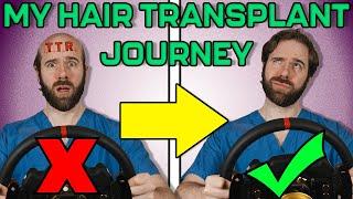 Sim Racing Surgeon Gets a Hair Transplant! | The Journey