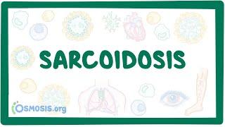 Sarcoidosis - causes, symptoms, diagnosis, treatment, pathology