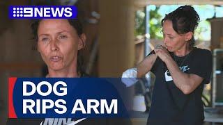 Mum says she doesn't blame her dog after it ripped her arm off | 9 News Australia