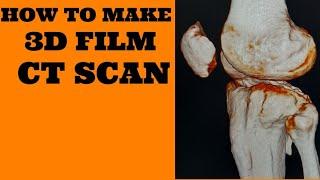 CT SCAN 3D FILM